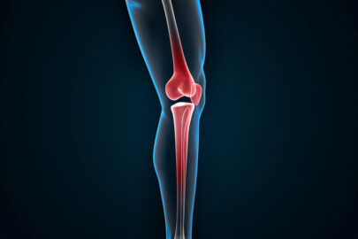 Knee joint pain - slon.pics - free stock photos and illustrations