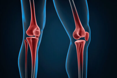 Injured knees close-up - slon.pics - free stock photos and illustrations